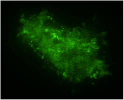 TIRF image of PAR expression on the cell surface